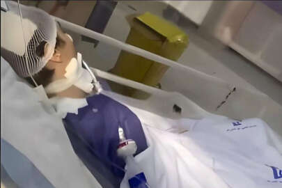 İran'da başörtüsü takmadığı için dövülen 16 yaşındaki kızın beyin ölümü gerçekleşti!