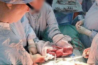 Çin yönetimi Uygur Türkü kadınlara zorla kürtaj uyguluyor!