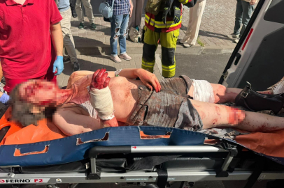 Rusya, Kıyiv’de gazetecileri vurdu: 5 yaralı!